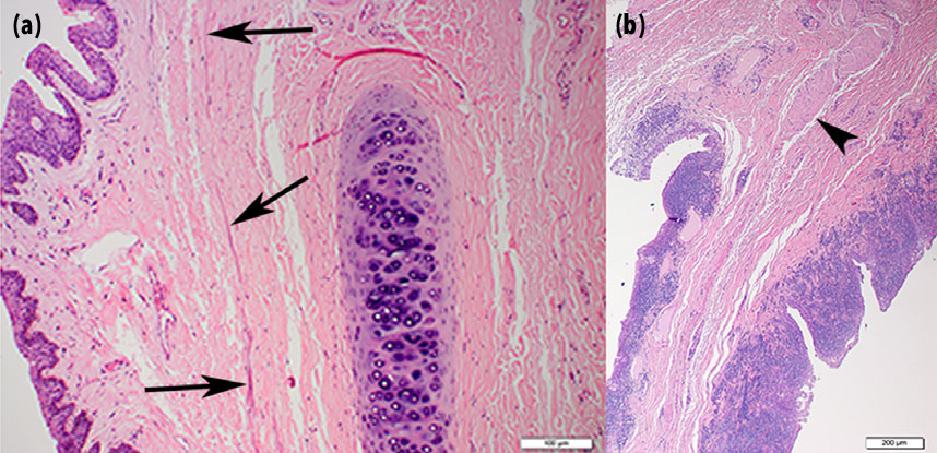 Leiomyoma - Photomicrographs of two canine third eyelids