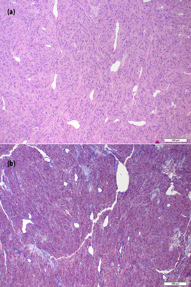 biopsy of the third
eyelid mass in dog
