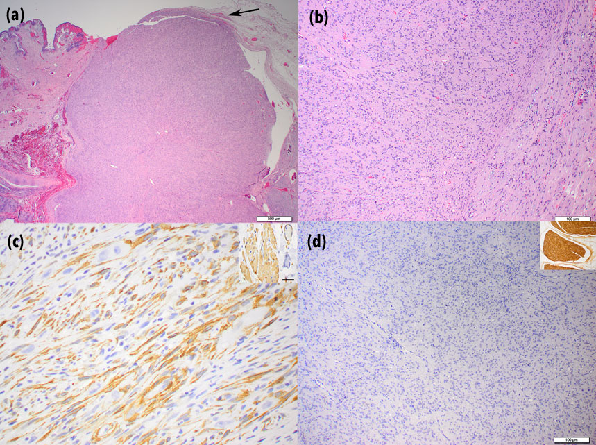 Leiomyoma in dogs - photomicrographs from the excised mass