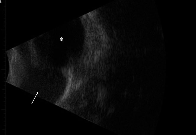 ultrasonographic image of a dog's third eyelid